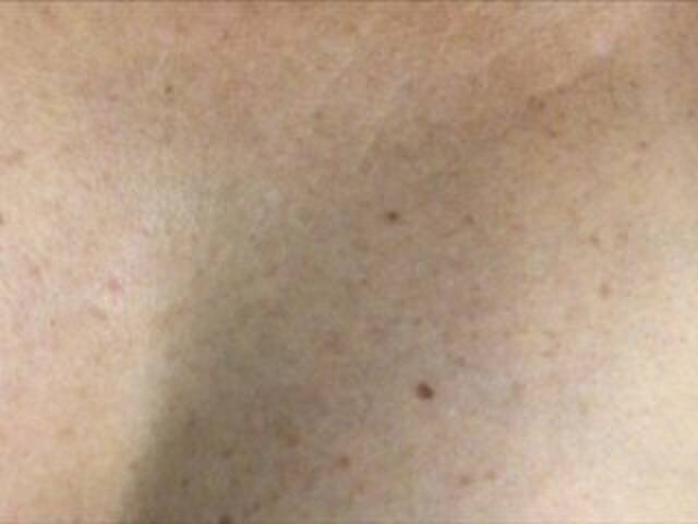 Snímky obrazovky vysielania Alianakiss