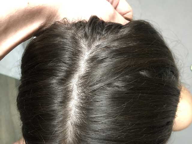 Profilová fotka bellatoni