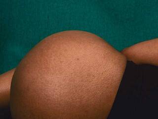 Erotický videohovor bustyboobsxxll