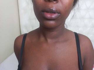 Erotický videohovor Freakynessa